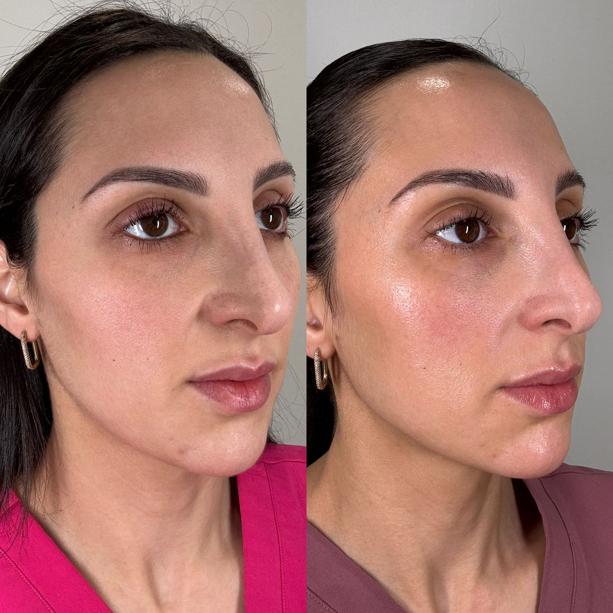 Before and after results